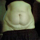 The day before surgery 11/17/2011