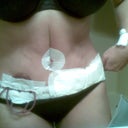 Afternoon of surgery 11/18/2011 Home!!