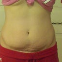 Front view before