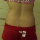 Back view before