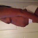 side pre-op