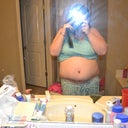 5weeks post front