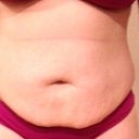 Day Before Procedure
