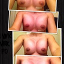 Day 1 PO..week 1 PO..week 2 PO..week 3 PO from top to bottom