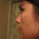 Side contour at this time. Non-smiling.