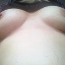 10 day po scars