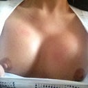 the best i could do for now! their really sore. more so than tight. 6 hours post op