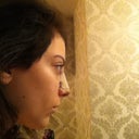 This is my profile view the day of the surgery. Holy crap what a difference! I love it so far.