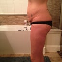 Side view - UGH!