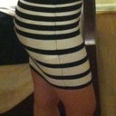7 weeks post op. Side view. I am happy!