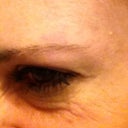 one week after