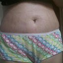 Post op day 3, swollen