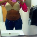 Seven weeks post op
