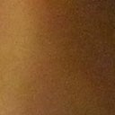 Bloodhound eye