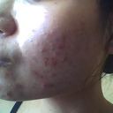 another cheek week#2