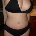 Belly button scar is lightening up