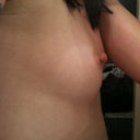 Side view left breast