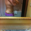 9 hours post op