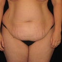 can you believe this is the body of a woman who worked out most days of the week for 7 years.  And counted her calories!  So FRUSTRATING!