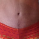 Thoughts on the spot under my bb?  Is it getting smaller?
