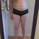 Before - Inner thighs that have always rubbed!