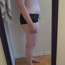 Before - Side