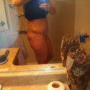 2 weeks post op