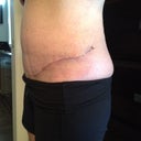 The overhang is officially gone!!!!!! WHOO-HOO!! I just can't believe that's my tummy....still surreal!
