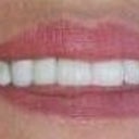 firs week they look nice and white on this picture