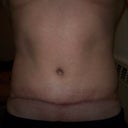 Seven weeks front