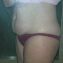 Check out the moles in the shape of the Big Dipper handle.  Before my twins they were a straight line down my side.  Who thinks that with a little diet & exercise those moles are just going to jump back to where they used to be?