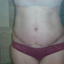 4 wks PO