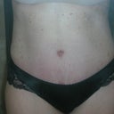 4 wks PO.  This body hasn't seen any kind of a 2 piece bathing suit - not even a tankini - in over 20 yrs!  But I could do it!