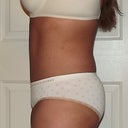 left view 14wks