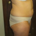 right side before