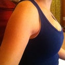 Day 9 post op. From the sides you can kinda see how they look funky