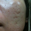 before picture of the right