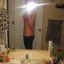 1 day post-op