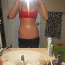 1 dat post-op