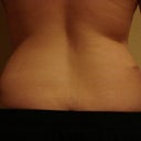 six weeks post opt. 11-21-10