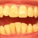 7-4-2012 Tray 9/24