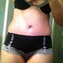 2wks  PO
Still swollen on sides