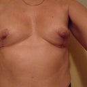 After front ugh