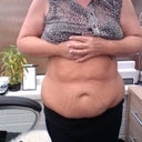 Day before surgery