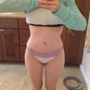 12 weeks postop