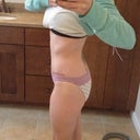 12 weeks postop