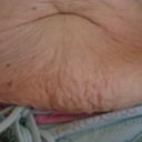 wrinkly stomach