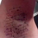 Left pit 4 hours after, not very swollen yet