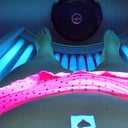 And a tanning pic for fun :) I would have never worn a swimsuit like this before the surgery!