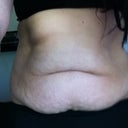 Tummy Before picture. TT scheduled for May 30th 2012, nervous and excited!